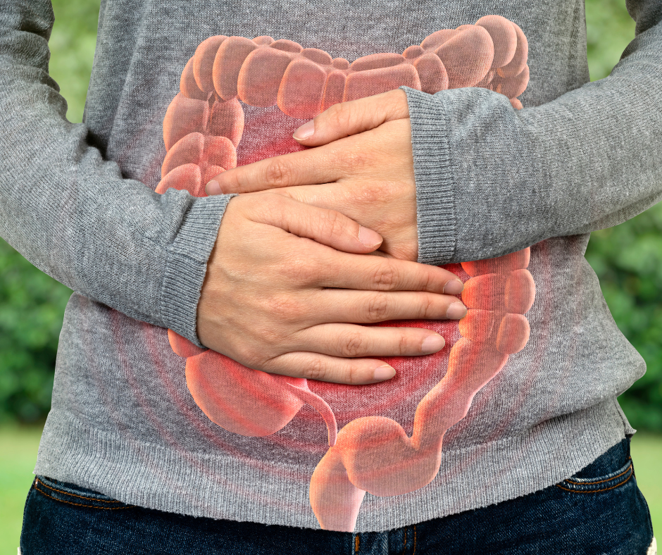 O que é endometriose intestinal? 