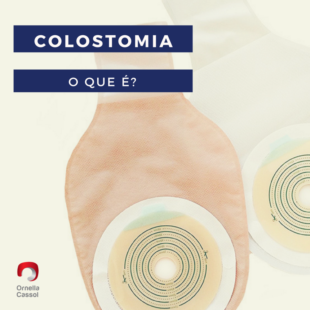 O que é colostomia?