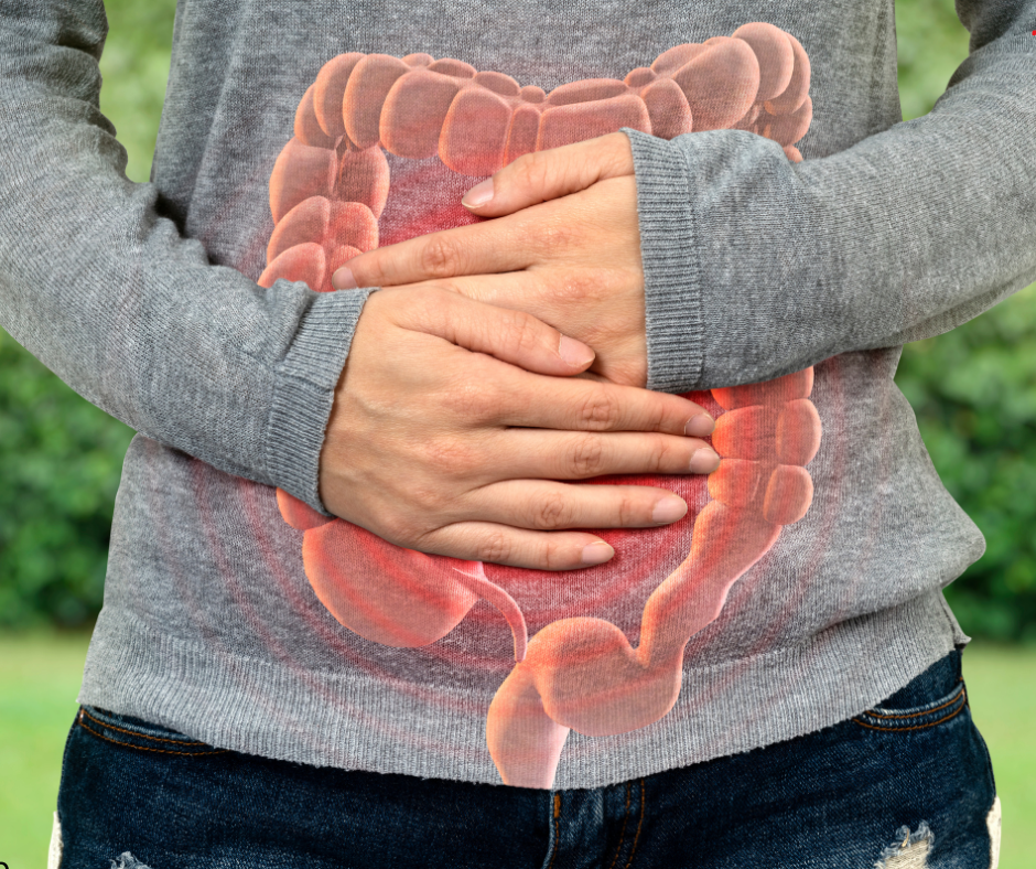Candidíase e a saúde intestinal 